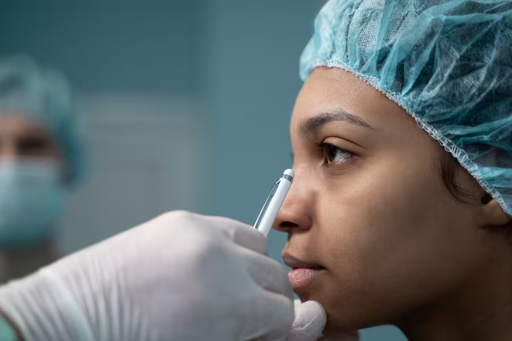 What to Expect Before Choosing Nose Filler Treatments in Beaconsfield